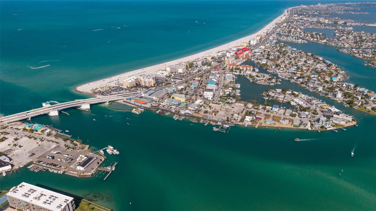 Image 10 of 13 For 13304 Gulf Boulevard